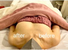 マホラ 高崎駅東口店(Mahora)/施術後のこの違いに注目！！