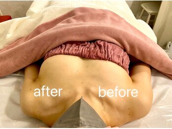 マホラ 高崎駅東口店(Mahora)/施術後のこの違いに注目！！