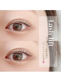 ディンプル(Dimple)/