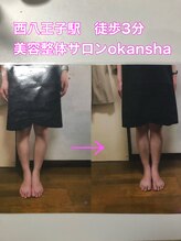 美容整体サロン オオカンシャ(okansha)/O脚Before→after