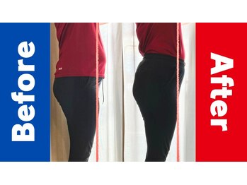 ザ コンディショニングルーム コガオスタジオ 自由が丘店(KOGAOSTUDIO)/ビフォーアフター　お腹