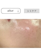 アイチューズ(ICHOOSE)/ナノホワイトセラムを導入♪