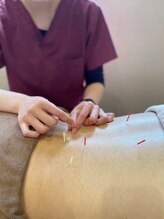 美波整体院 本宮院/鍼灸施術