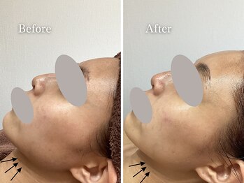 エリー(Ellie)/前撮り前と結婚式前に2回ご来店