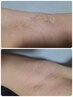 【石田担当◯】両ワキWax脱毛　