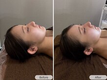 ルルミリ 心斎橋(Lulumili)/すっきり小顔矯正ケア