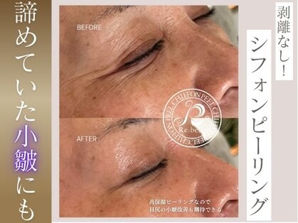 セレネ(SELENE)の写真