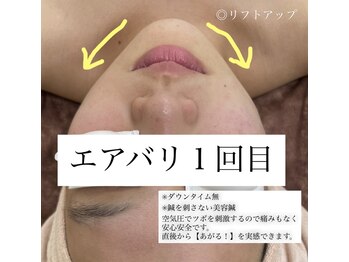 ローズ(Rose)/エアバリ