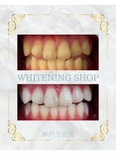 ホワイトニングショップ 三ノ宮店/【お客様のビフォーアフター】