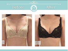 美人バスト 岡崎店/【バストアップ★】症例
