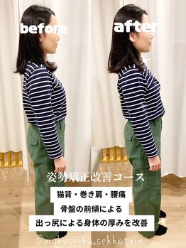 木犀花/オーダーメイド骨盤矯正