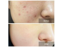 美肌ラボ クリア(clear)の雰囲気（お肌に合ったメニューのご提案◎どんなお悩みもご相談ください！）