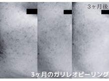 フロート(float)/