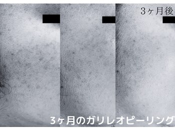 フロート(float)/