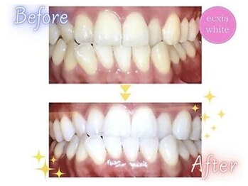 エクシアホワイトニング 静岡駅前店