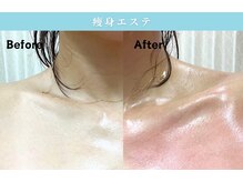 アーヒル(A”-HILU)/セルゼロ