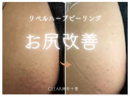 クリア 麻布十番(CLEAR)の写真