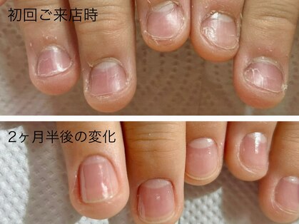 リリー(Lilly)の写真