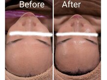 レアナ(LEANA)/全身痩身90分＆フェイシャル60分