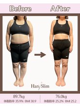 ビーネ 札幌琴似/ハリスリム 札幌琴似(Beene/Hari-Slim)/3ヶ月-13.7kg