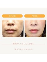 ムーンライズ(moonrise)/