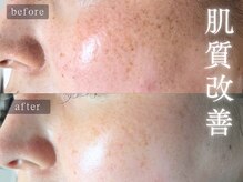 アムールサロン(Amour salon)