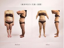 ベルミナ(Belmina)/大名/天神/毛穴/脱毛/痩身