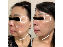 ヴィーナス(VENUS)の雰囲気（1回の導入で驚く人続出！上質なヒト幹細胞培養液を体験できます）