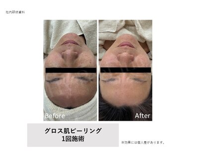 グロウラ(GrowRa)の写真
