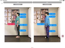 ナオル整体 浅草院(NAORU整体)/40代男性【反り腰・腰痛】