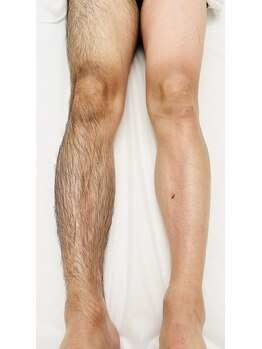 リアン(Rian)/メンズ/足脱毛/ワックス