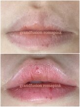 テセラ(Tethere)/ローマピンク