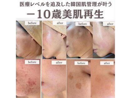エスビューティー 三軒茶屋(S beauty)の写真