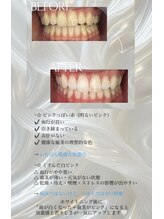 ピュアティス(PURETETH)/デンタルケア