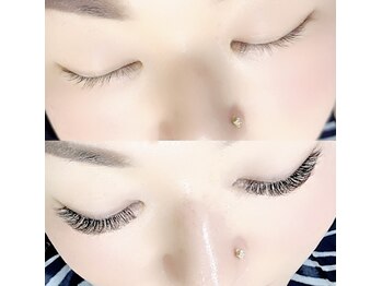 ファストラッシュ 表参道(FAST LASH)/VLEDLASH900本ビフォーアフター