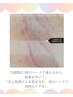【脱毛・夏に向け今】　ワキ脱毛　＋美白パック付き♪　45分　¥5,500 → ¥660