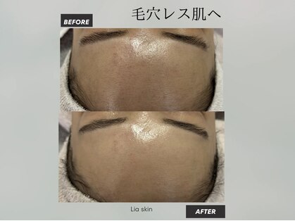 リアスキン(Lia skin)の写真