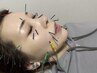 【ほうれい線ケア美容鍼】ほうれい線が気になる方に◎ 30分 ￥4,400→￥3,300