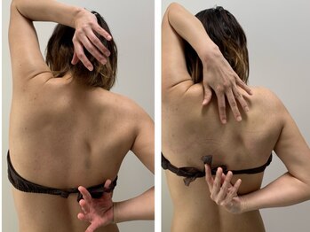 チャロアイト 可部店(Charoite)/筋膜リリース