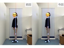 鴨島坂口整骨院/ビフォーアフター