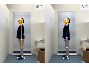 鴨島坂口整骨院/ビフォーアフター