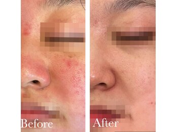 MMK/なめらか素肌で毎日がhappyに