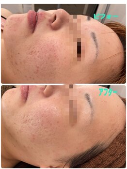 アモ(amo)/クリスティーナアンストレス