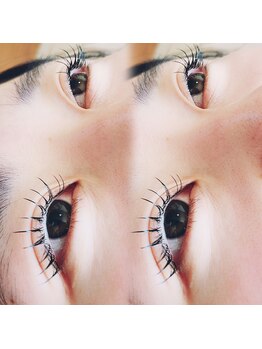 コア(Koa)/フラットラッシュ100本