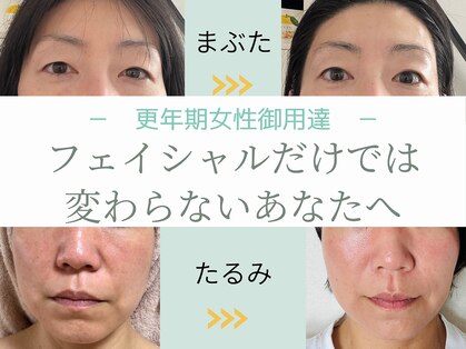 たるみアガル(たるみagaru)の写真