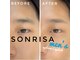 ソンリサ(SONRISA)の写真