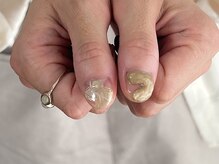 アテ(ate.)/【お任せアート10本】