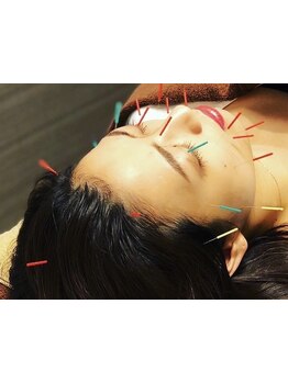 鍼灸施術を受けたい