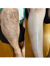 エヌ サロン(enu salon)/男性用フルレッグ