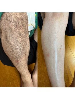 エヌ サロン(enu salon)/男性用フルレッグ